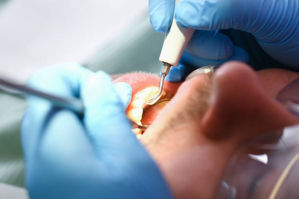 Best Broken or Chipped Tooth Repair in Piney, AR
