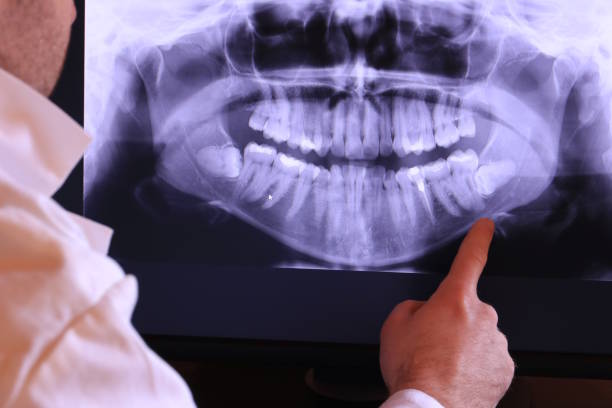 Best Emergency Root Canal Therapy in Piney, AR
